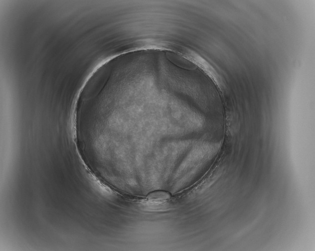 X0000113051140200909171536