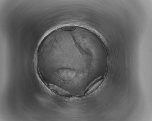 X0000113051522200909171531