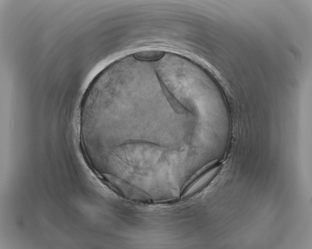 X0000113051522200909241444