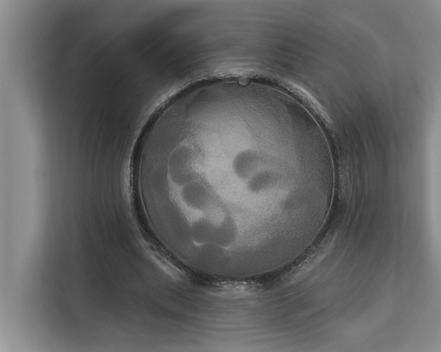 X0000113060439200908281137