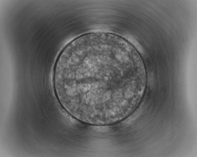 X0000113060856200908281133