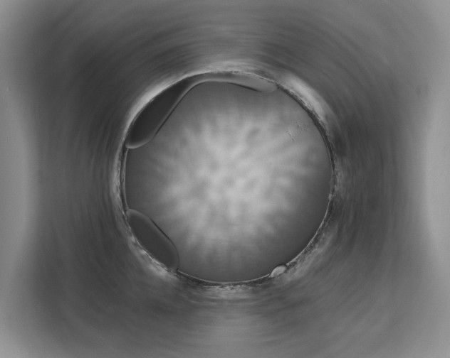 X0000113060952200908281131