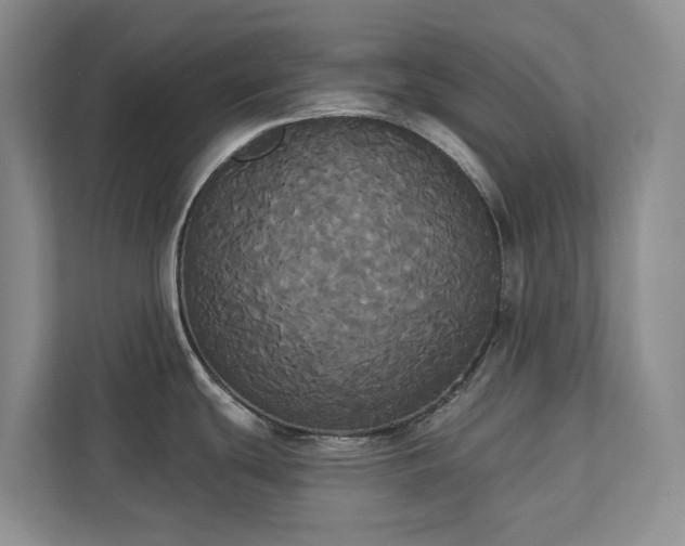 X0000113061439200908281125