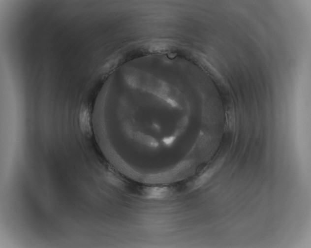 X0000113060575200909041040