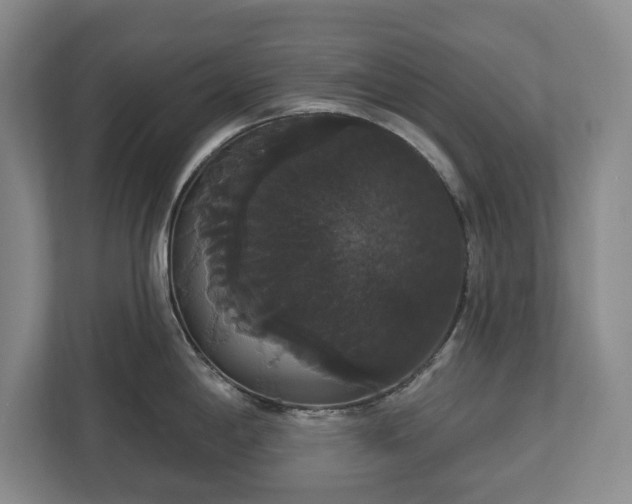 X0000113061198200909041031