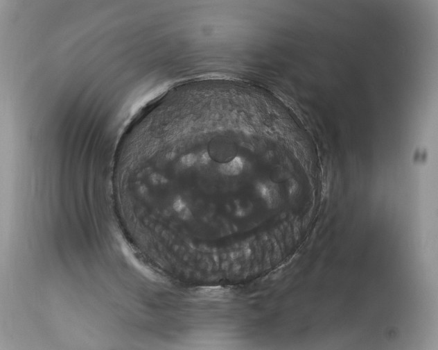 X0000113060050200909110925