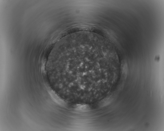 X0000113060185200909110925
