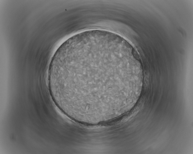 X0000113061535200909250858