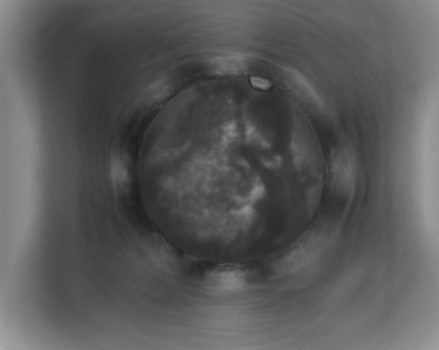 X0000113070228200909041104