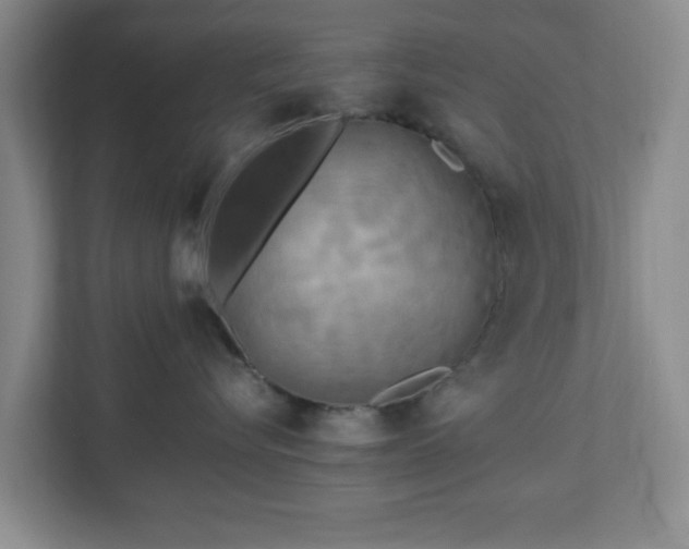 X0000113070576200909041100