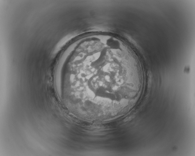 X0000113071215200909182017