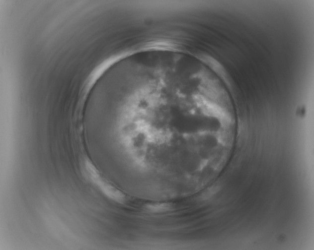 X0000113071435200909182014