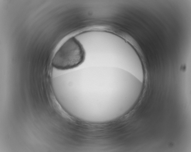 X0000113071436200909182014