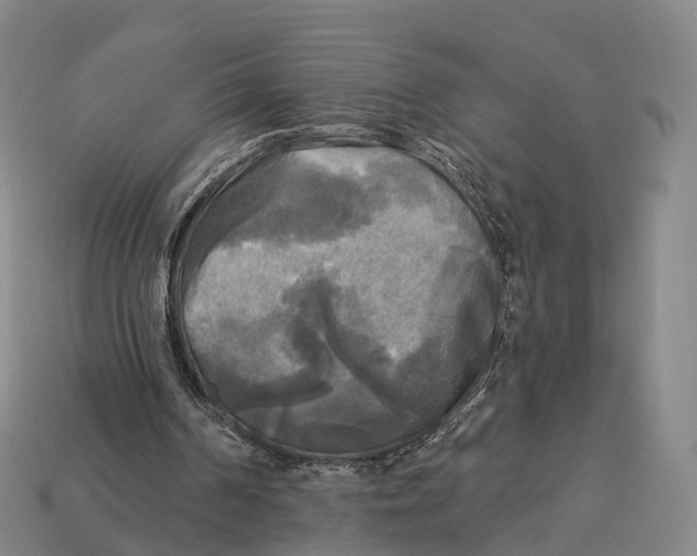 X0000113100194200909251038