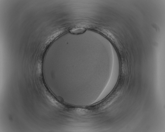 X0000113110393200909181633