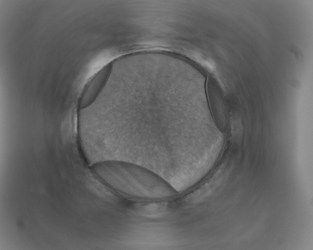 X0000113111365200910091151