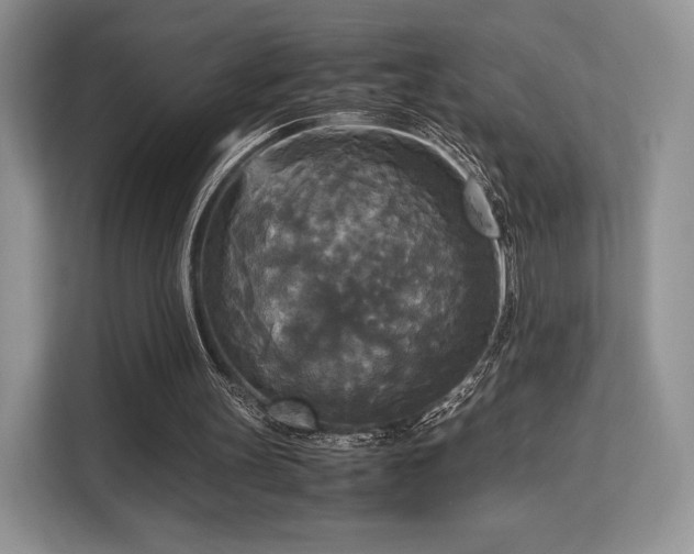 X0000113140147200909110941