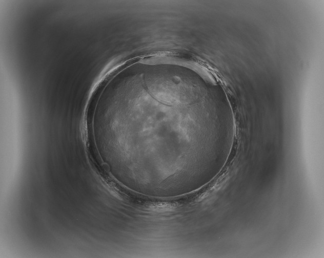 X0000113140198200909110941