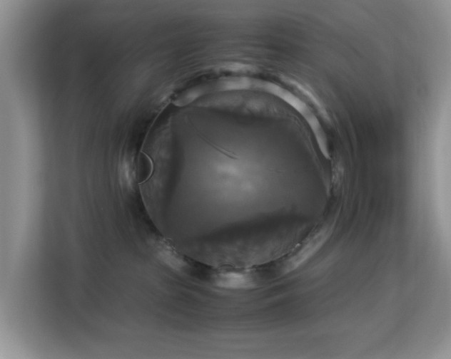 X0000113140285200909110940