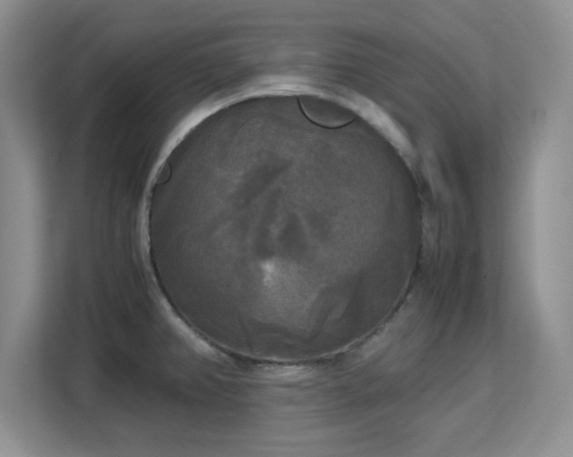 X0000113141382200909110925