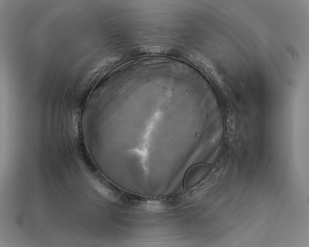 X0000113140114200909181738