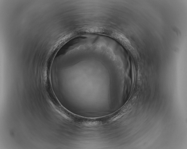 X0000113140202200909181737