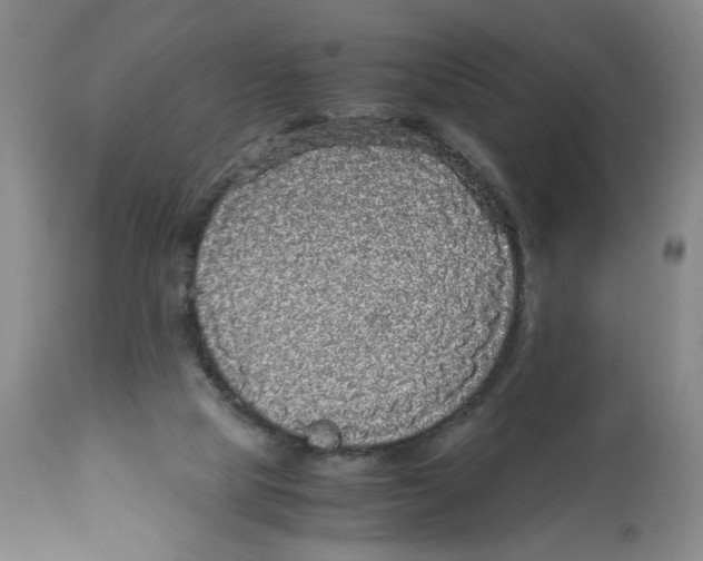 X0000113140065200910021449
