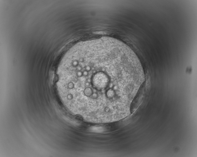 X0000113140171200910021448