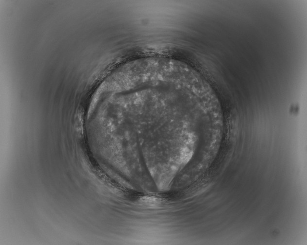 X0000113140699200910021440