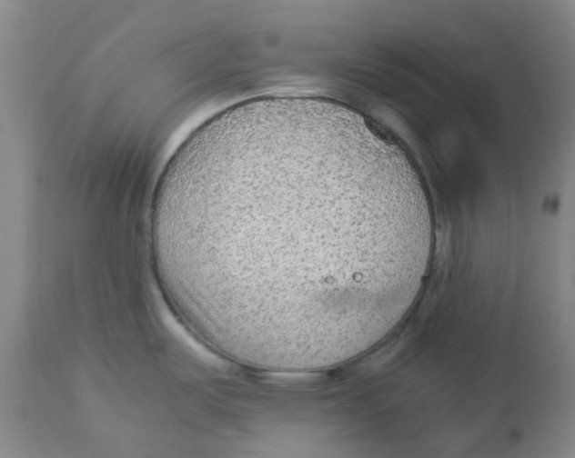 X0000113141487200910021428