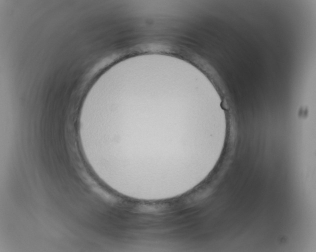 X0000113140625200910161156