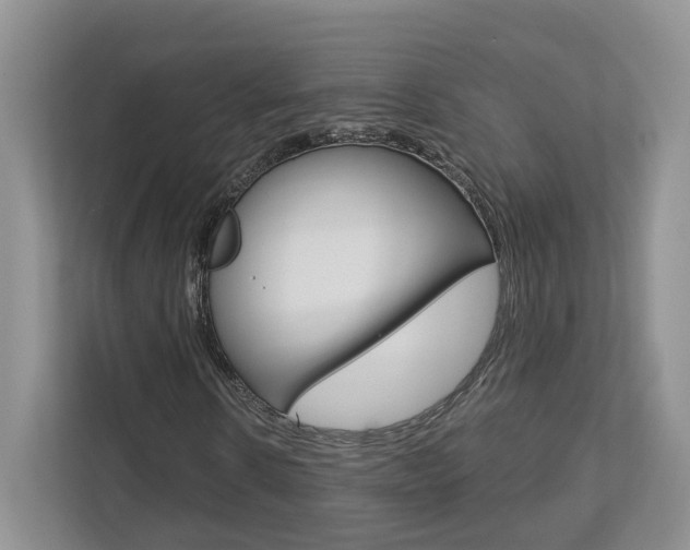 X0000113170914200909040931