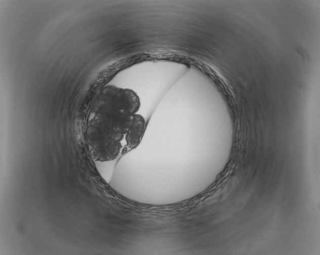 X0000113171016200910021518