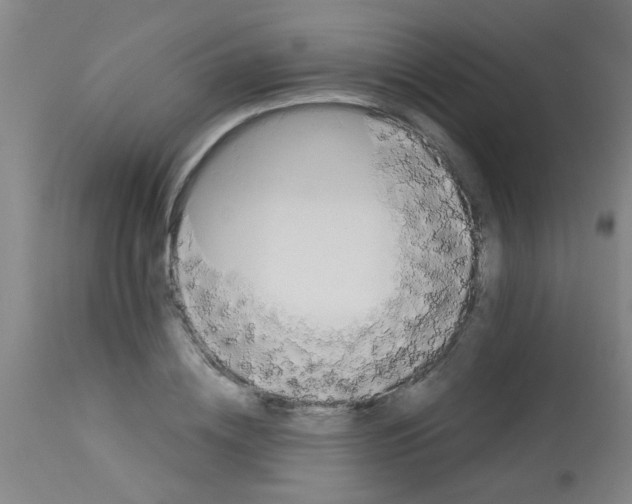 X0000113170836200910161306