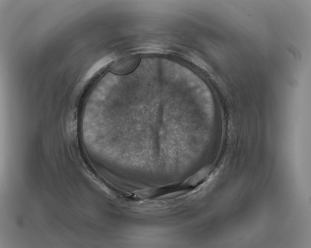 X0000113181450200910021533
