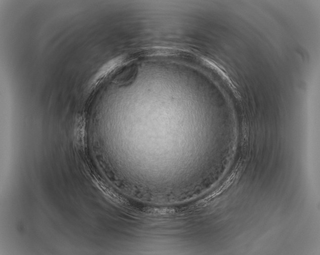 X0000113201403200909171504