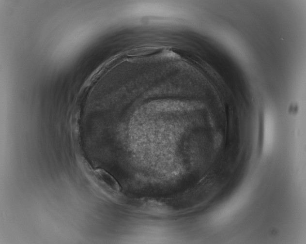 X0000113200387200910011301