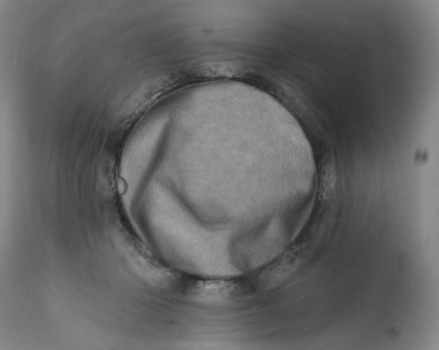 X0000113200414200910011300