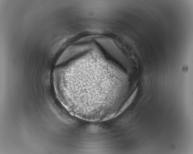 X0000113200596200910011258