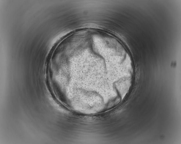 X0000113200987200910011252