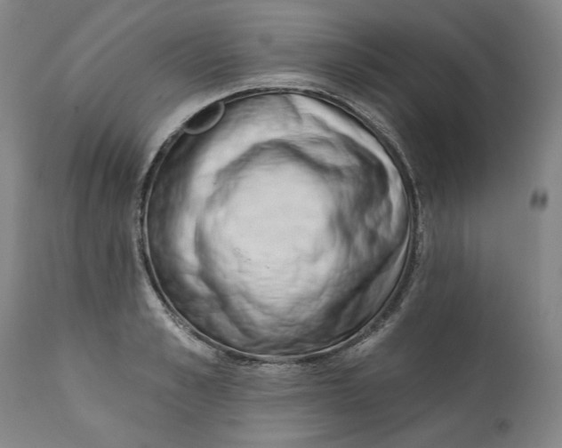 X0000113200989200910011252