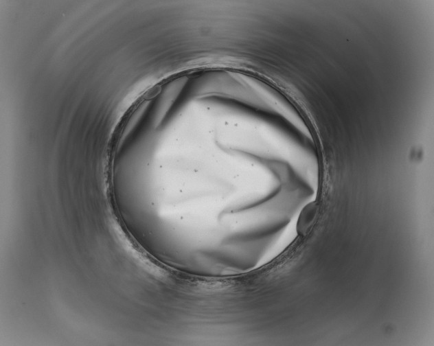 X0000113200997200910011251