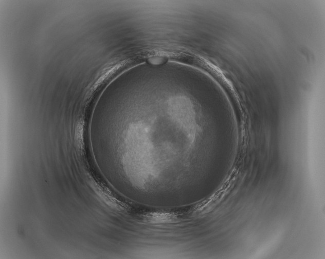 X0000113220154200909101157