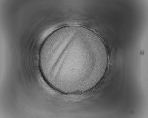 X0000113220005200910011357