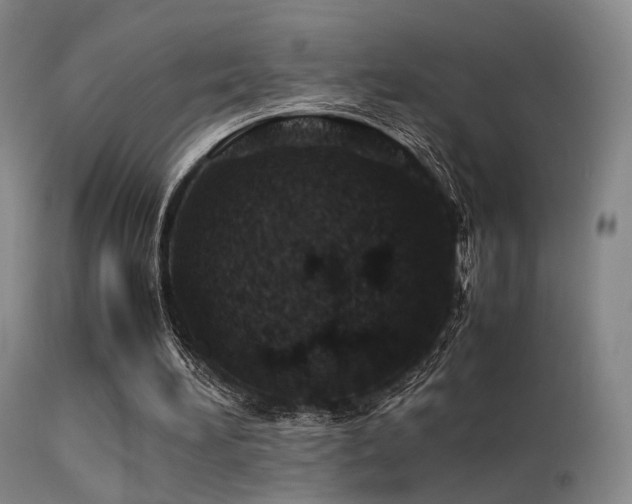 X0000113240196200909171611