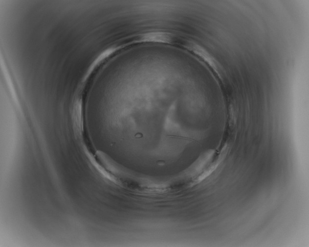 X0000113251123200909101423