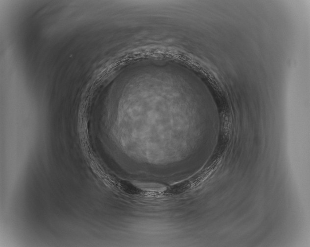 X0000113251489200909101417