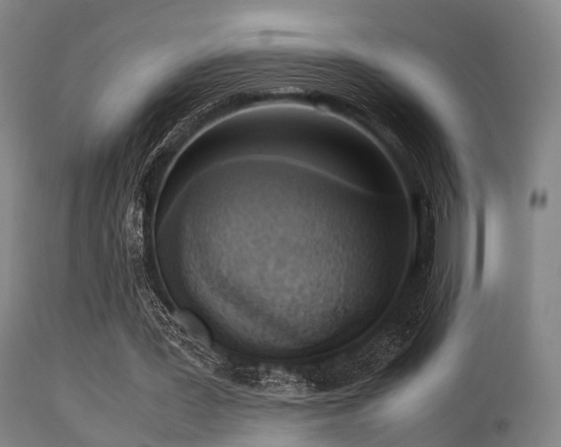 X0000113250387200909171631