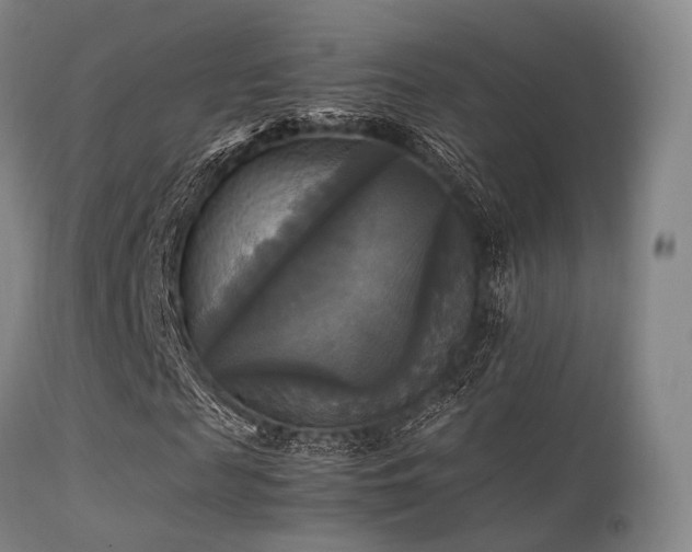 X0000113250817200909171623