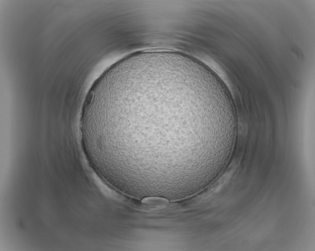 X0000113251485200910011336